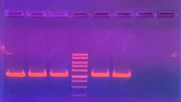 Электрофорез ДНК в агарозном геле. Фото: Николай Разуваев